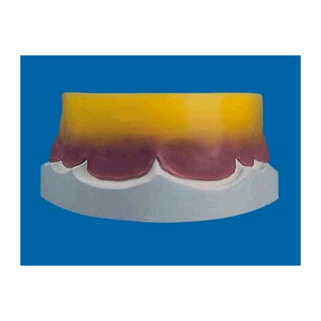 ERKOPLAST R DM125x125 2,5 p.50 554425