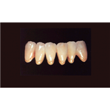 SILVER INCISAL ARANCIONE oz.1