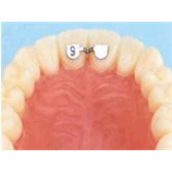 KIT F3812-93 RITENTORI