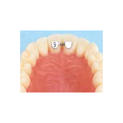 KIT F3812-93 RITENTORI