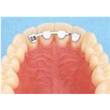 RITENTORI F3822-18 DB