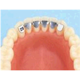 RITENTORI F3836-29