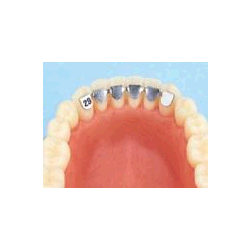 RITENTORI F3836-35